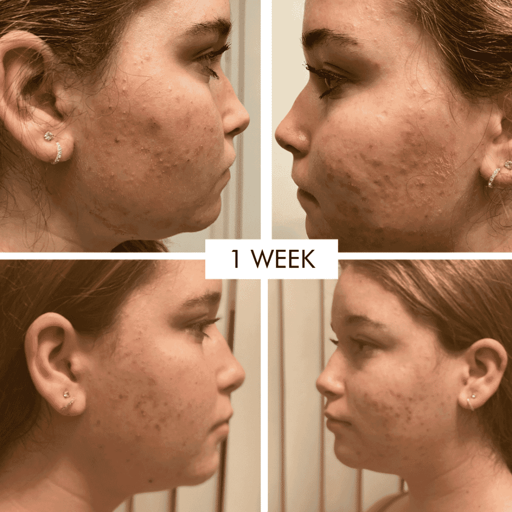 All's Well That Gels Well Purifying Gel 30ml