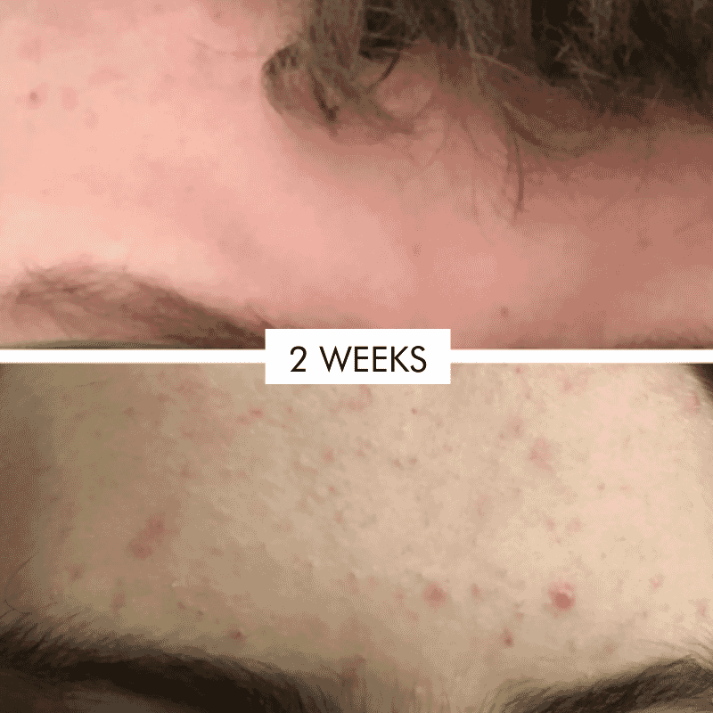 Best Cleanse Forever Cleansing Face Wash 100ml