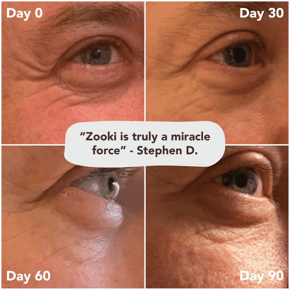 Collagen Liquid Sachets Sour Cherry Flavour Super Strength 11,000mg 30x18.5ml Sachets (CASE)