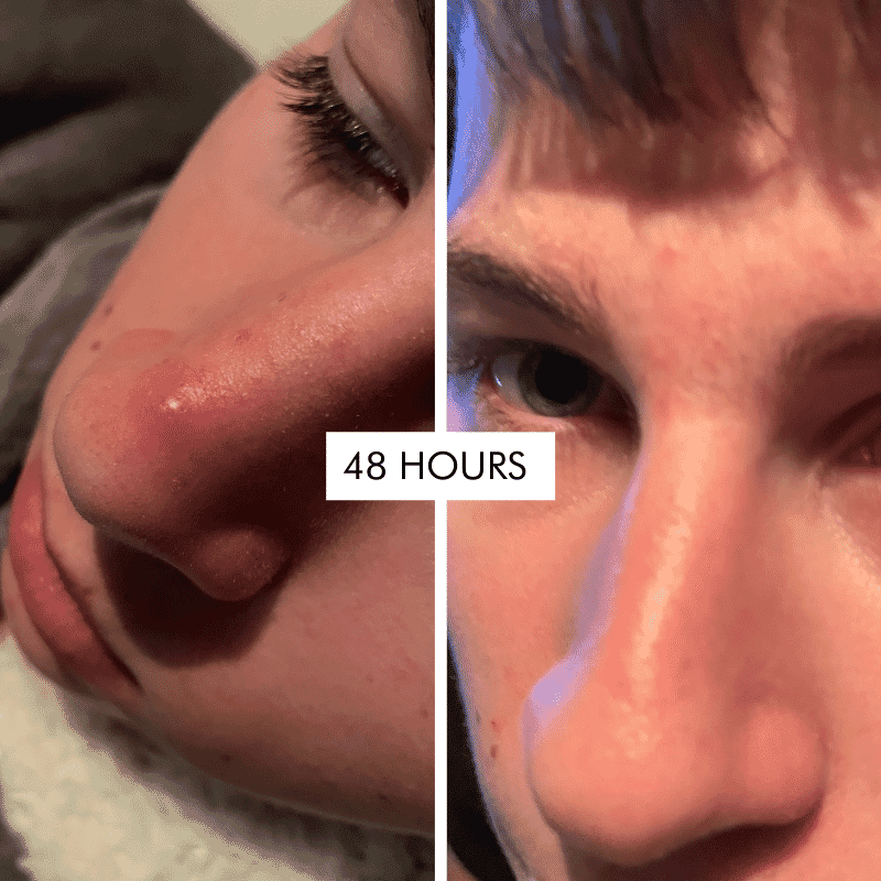 Hits The Spot Purifying Gel