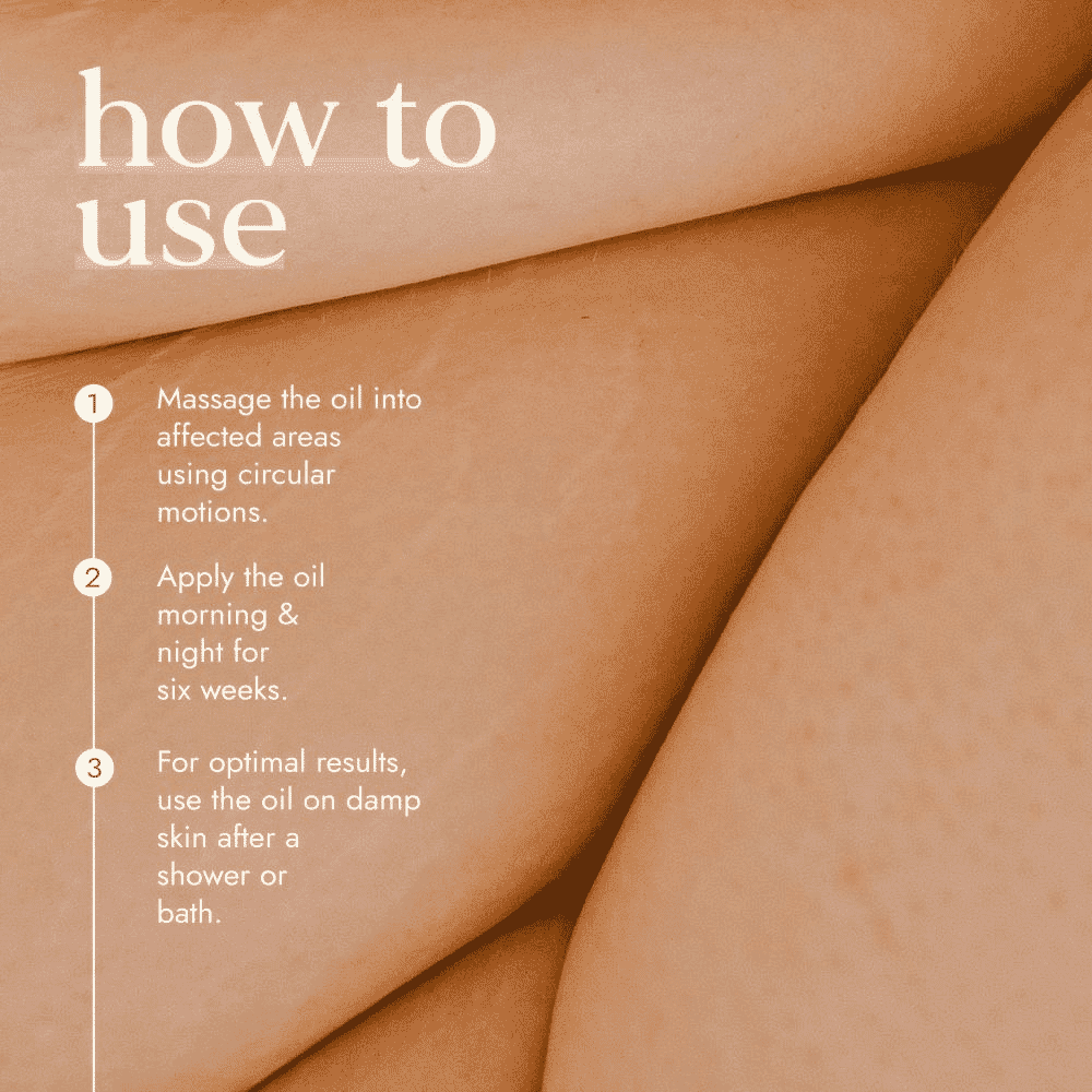 Really Good Stretch Mark Oil 100ml