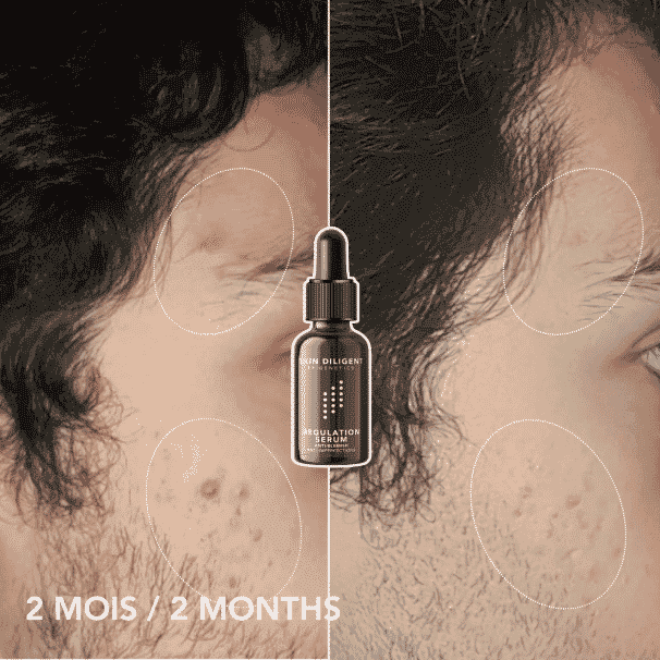 Regulation Serum 15ml