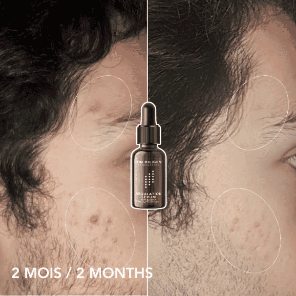 Regulation Serum 30ml