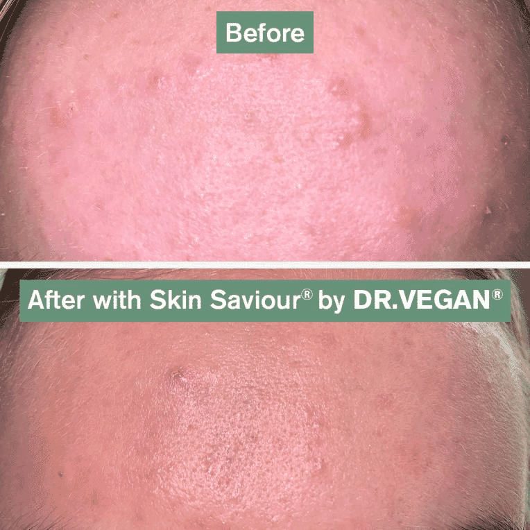 Skin Saviour 60s
