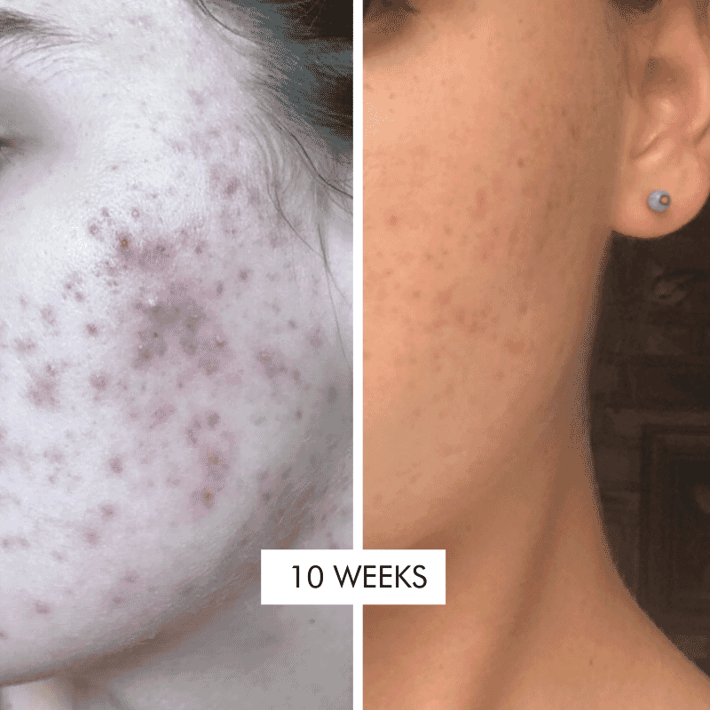 Soothe Operator Calming Moisturiser 50ml